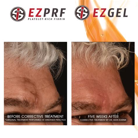 Ezgel Ezprf Allure Beauty