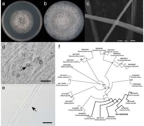 Colony Morphology After 7 Days A And 15 Days B Of Culture On Pda Download Scientific