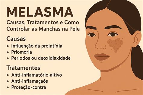 Manchas De Melasma No Rosto - Melasma: Causas, Tratamentos e Controle de Manchas