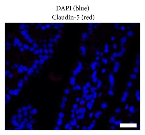 Claudin Surface Localization On Blood Vessel Endothelial Cells Does