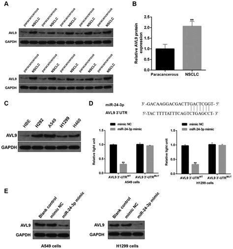 Hsa Circ 0058357 Acts As A CeRNA To Promote Nonsmall Cell Lung Cancer