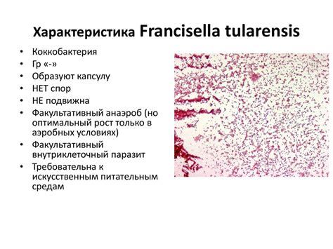 Возбудитель туляремии - презентация онлайн