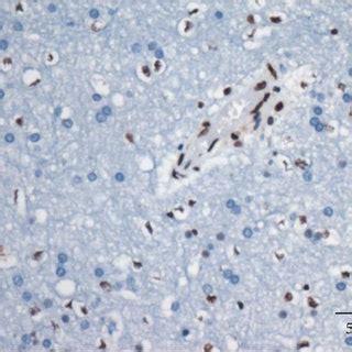 The Ptbp Protein Expression A No Expression In Normal Brain