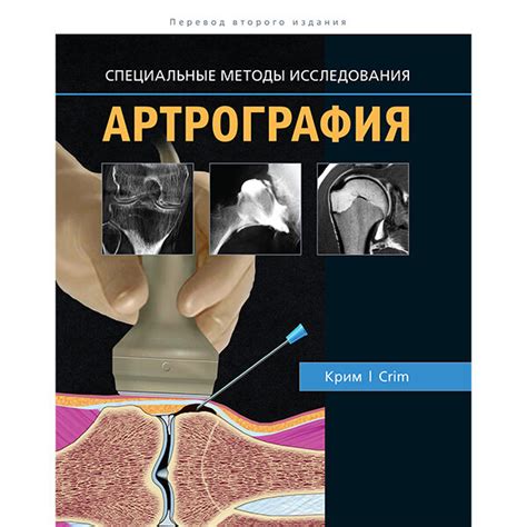 Книга "Артрография". Купить книги травматологии и ортопедии