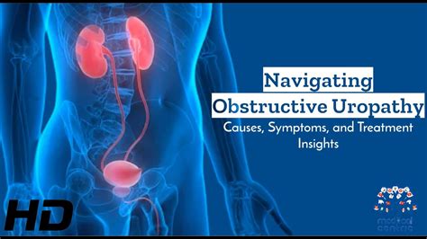 Obstructive Uropathy Explained: From Symptoms to Treatment - YouTube