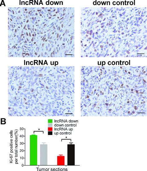 Lnc Rab B As Inhibits Osteosarcoma Cells Proliferation In Vivo A