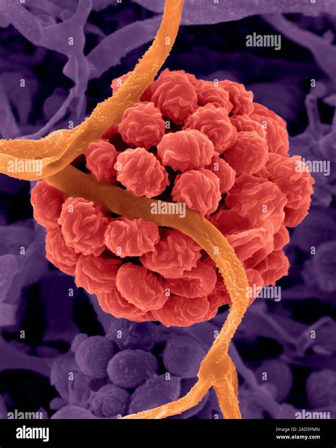 Coloured Scanning Electron Micrograph Sem Of Stachybotrys Sp