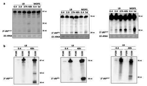 Stationary Phase Specific Transfer RNA Fragments A Northern Blot