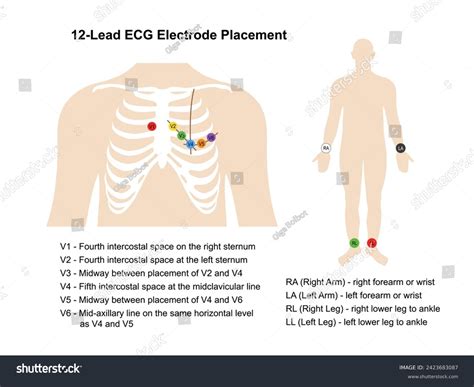 imagenes fotos de stock objetos en   vectores sobre  lead ecg