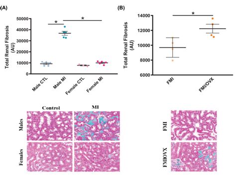 The Effects Of Mi And Ovx On Total Renal Fibrosis Total Renal Fibrosis Download Scientific