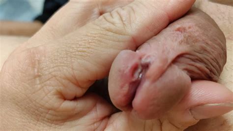 Gespaltener Penis Free Gay HD Porn Video XHamster