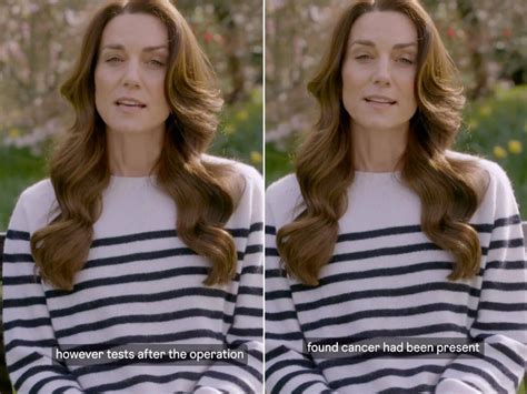 Kate Middleton Reveals Cancer Diagnosis, Has Started Chemotherapy