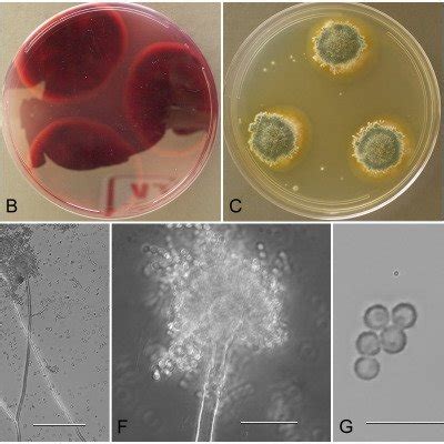 Aspergillus Puulaauensis NRRL 35641 Culture Plates Are 9 Cm Diam