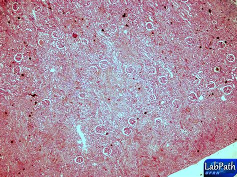 Laici Laboratório De Investigação De Câncer E Inflamação Necrose De