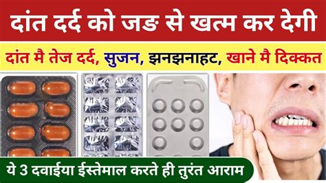 Dant Dard Ki Tablet Dant Dard Ka Ilaj Teeth Pain