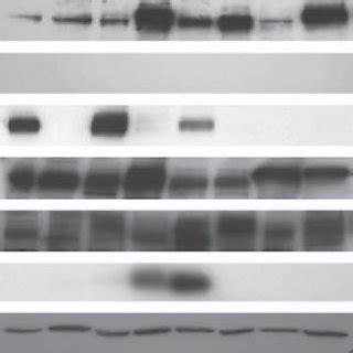 Expression Of Mrp Isoform Mrna In Primary Human Pancreatic Duct Cells