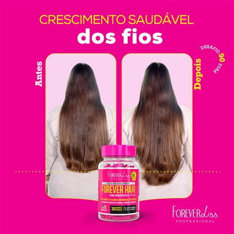 Vitamina D Cresce Cabelo - Vitamina B12 Cresce Cabelo: O Guia Definitivo [2026]