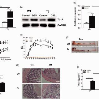TL1A overexpression aggravates intestinal mucosa inflammation in ...