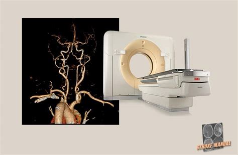 Aspect Score Stroke Manual