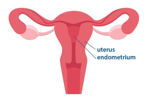 3 Facts About Endometrial Cancer What S Up At Upstate SUNY Upstate