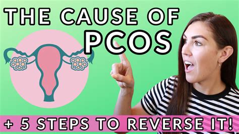 What Causes Pcos How To Reverse Pcos Health Coach Kait Insulin