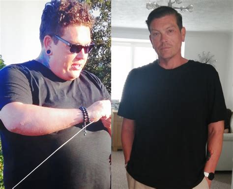 The Story Of Lifesaving Weight-Loss - 30 Stories for 30 Years