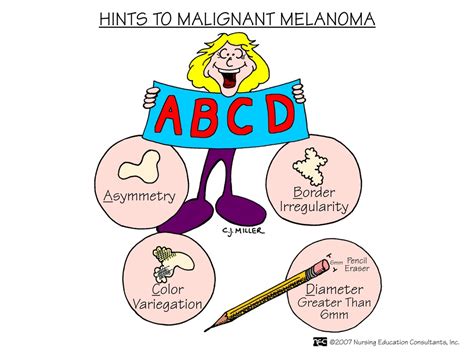 med surg picture mnemonics digital nurses station
