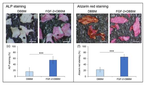Alp Staining And Alizarin Red Staining Of Mc3t3 E1 Cells On Dbbm