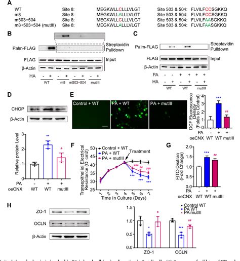 Figure 1 From Protein Palmitoylation Mediated Palmitic Acid Sensing