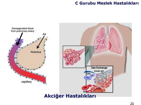 Yerlerinde Sa L K G Zetimi Ve Meslek Hastal Klar Ppt Indir