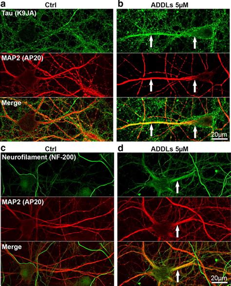 Aβ Oligomers Cause Localized Ca2 Elevation Missorting of Endogenous