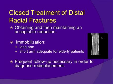 Dr Yt Reddy Distal Radius Fractures Modified