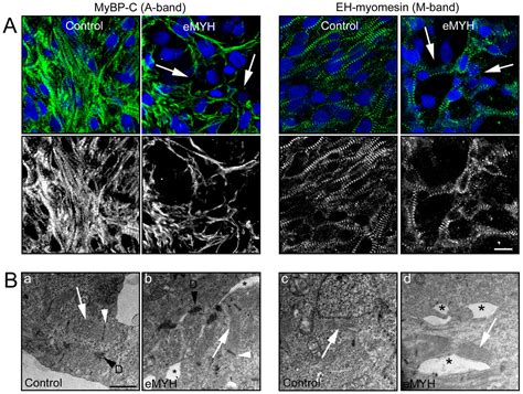 Knockdown Of Embryonic Myosin Heavy Chain Reveals An Essential Role In