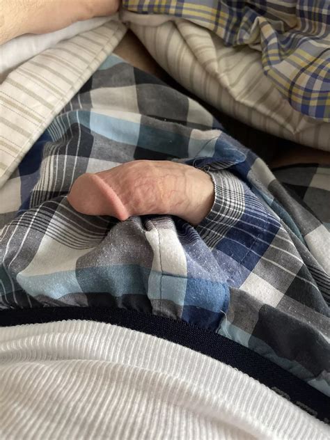 Trynna Get A Tan For My Pale Cut Cock Nudes Boxershorts NUDE PICS ORG