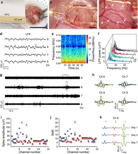 In Vivo Experiments Using Neuroweb A Optical Image Of Neuroweb Attached