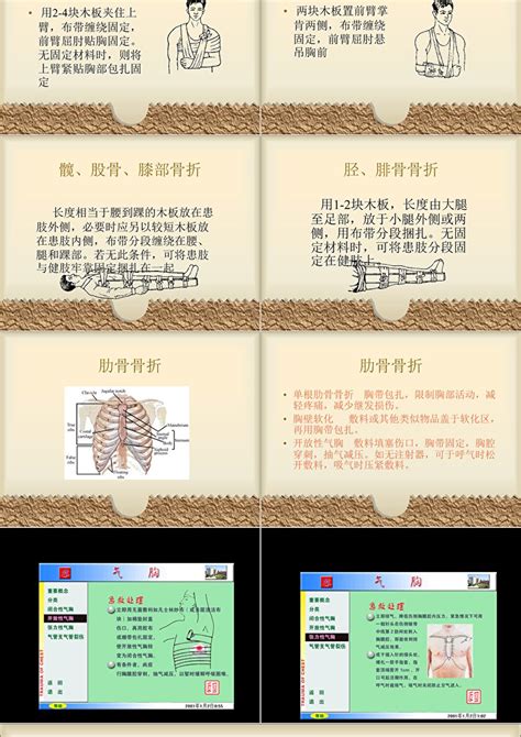 骨折的现场急救ppt模板卡卡办公