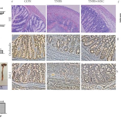 Human Umbilical Cord Derived Mesenchymal Stem Cell HUC MSC Therapy