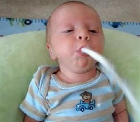 Projectile Vomit Pyloric Stenosis Animated My XXX Hot Girl