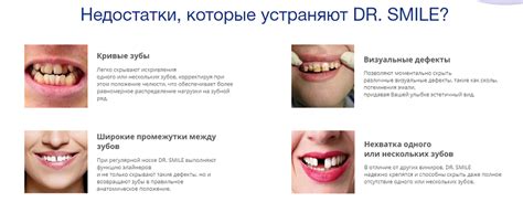 Виниры DR. SMILE - Цена, Отзывы, Где Купить в Аптеке!