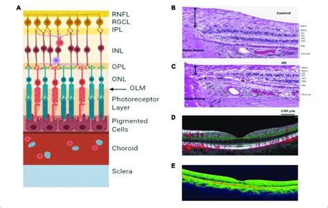 retinal layers  imaging   individual layers   retina
