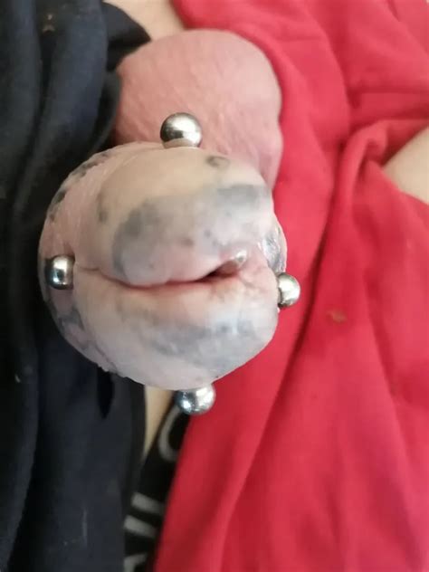 Sounding Urethra 41 Nude Pics XHamster