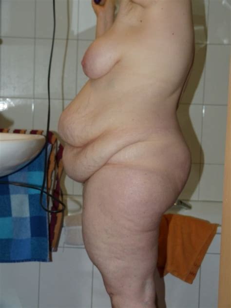 Expose Fatty Cfwives B Ca D D Porn Pic