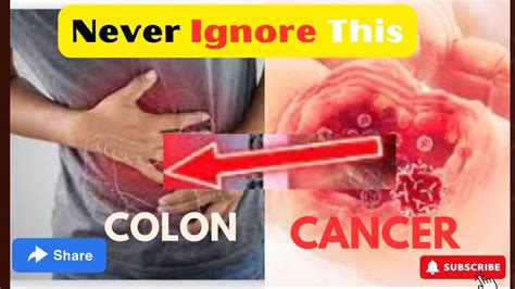 Most Colon Cancer Symptoms You Should Never Ignore Youtube