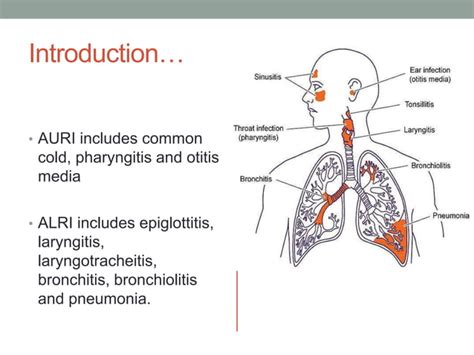 Acute Respiratory Infections Ppt