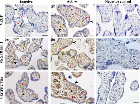 Immunolocalization VEGF A B VEGFR1 Flt1 D E And VEGFR2 Flk1