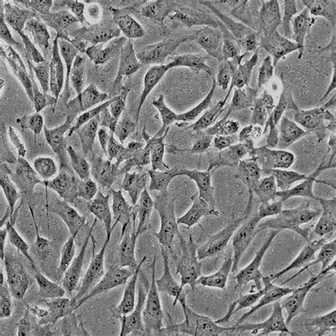 Human Gingival Fibroblasts Cells Online