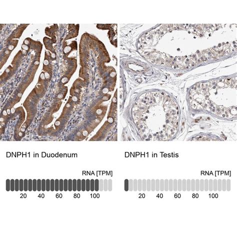 Rcl Polyclonal Antibody Invitrogen 100 μl Unconjugatedantibodies