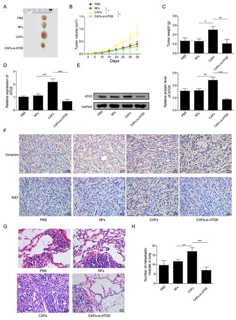 Depletion Of ATG5 In CAFs Inhibited Xenograft Tumor Growth Of PCa Nude