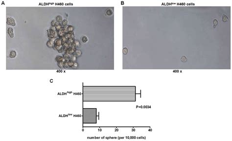 Sphere Formation Of The Aldh High And Aldh Low Cells A Total Of