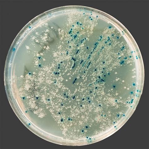Premium Photo Bacterial Colonies On Agar Plate